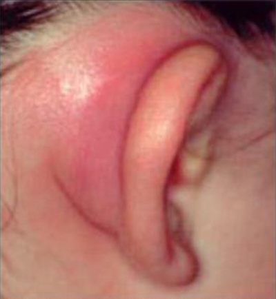 Pate In Ear Base Bank of SBA questions