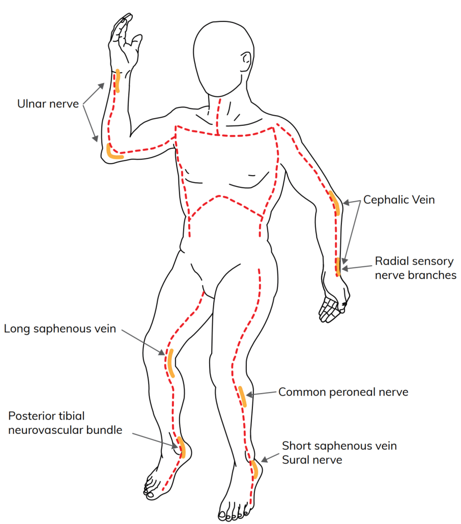 FRCEM Secrets | Structured Notes & Practice Questions for FRCEM